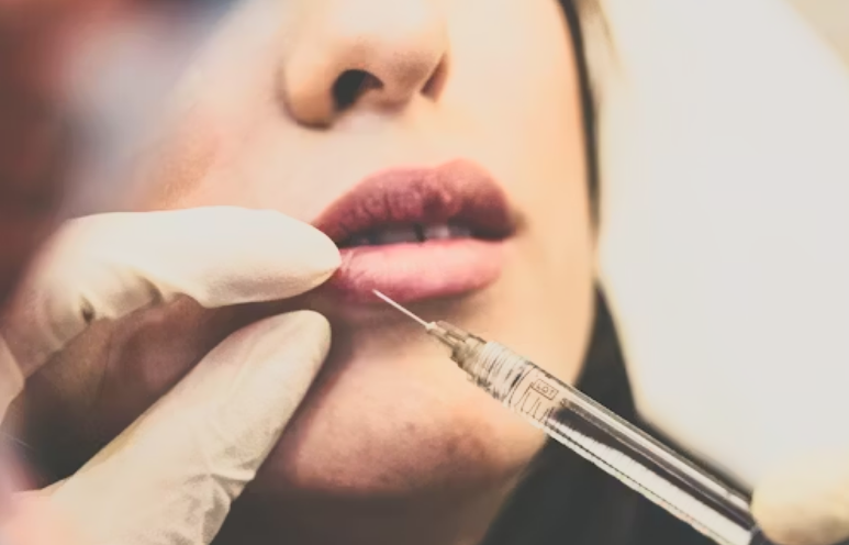 4 Positives to Know Before Opting for Professional Dermal Fillers 