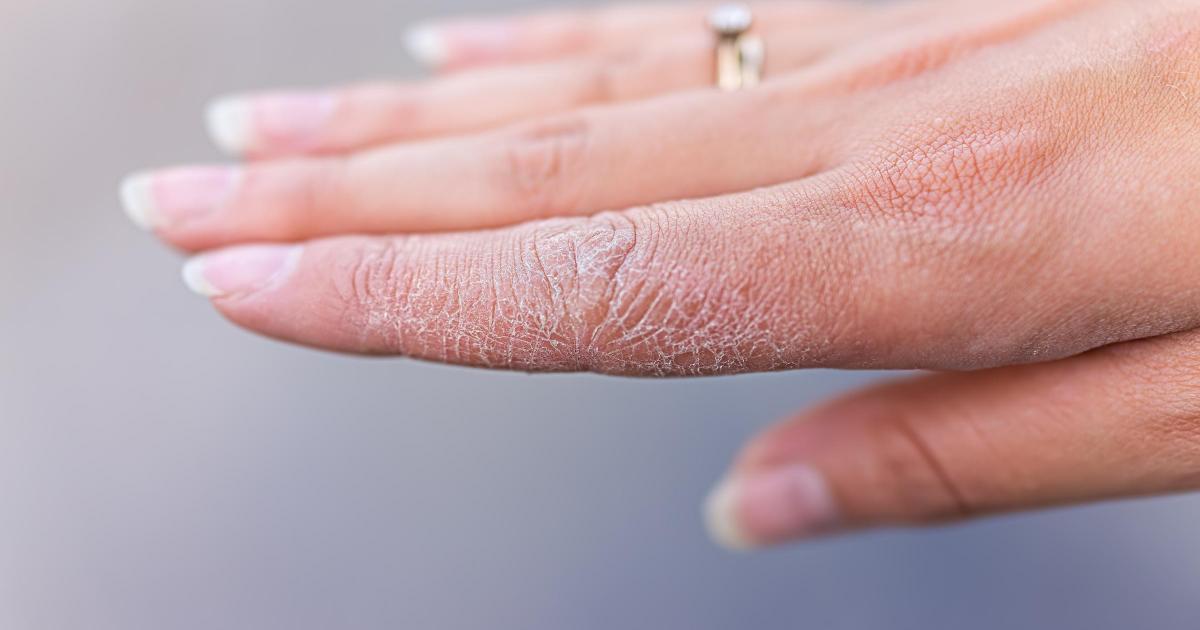 What foods helps clear skin? Skincare expert issues advice
