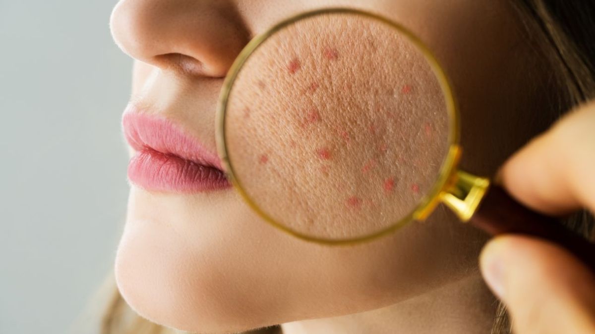 Everyday mistakes that slowly damage your skin barrier