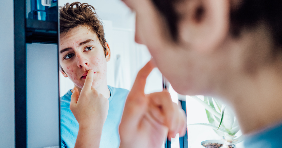 Dermatologists warn teens and parents about social media skincare risks
